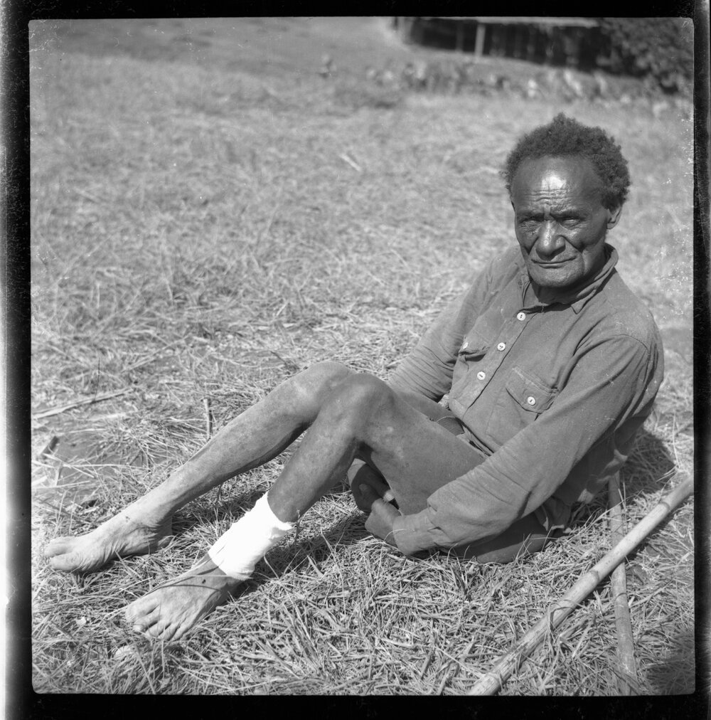 Man Sitting with Bandaged Leg