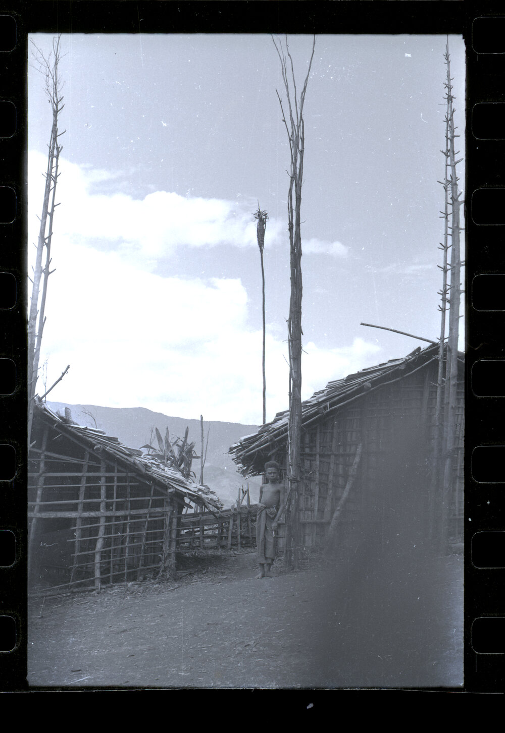 Boy Standing at the Base of an Empty Food Pole