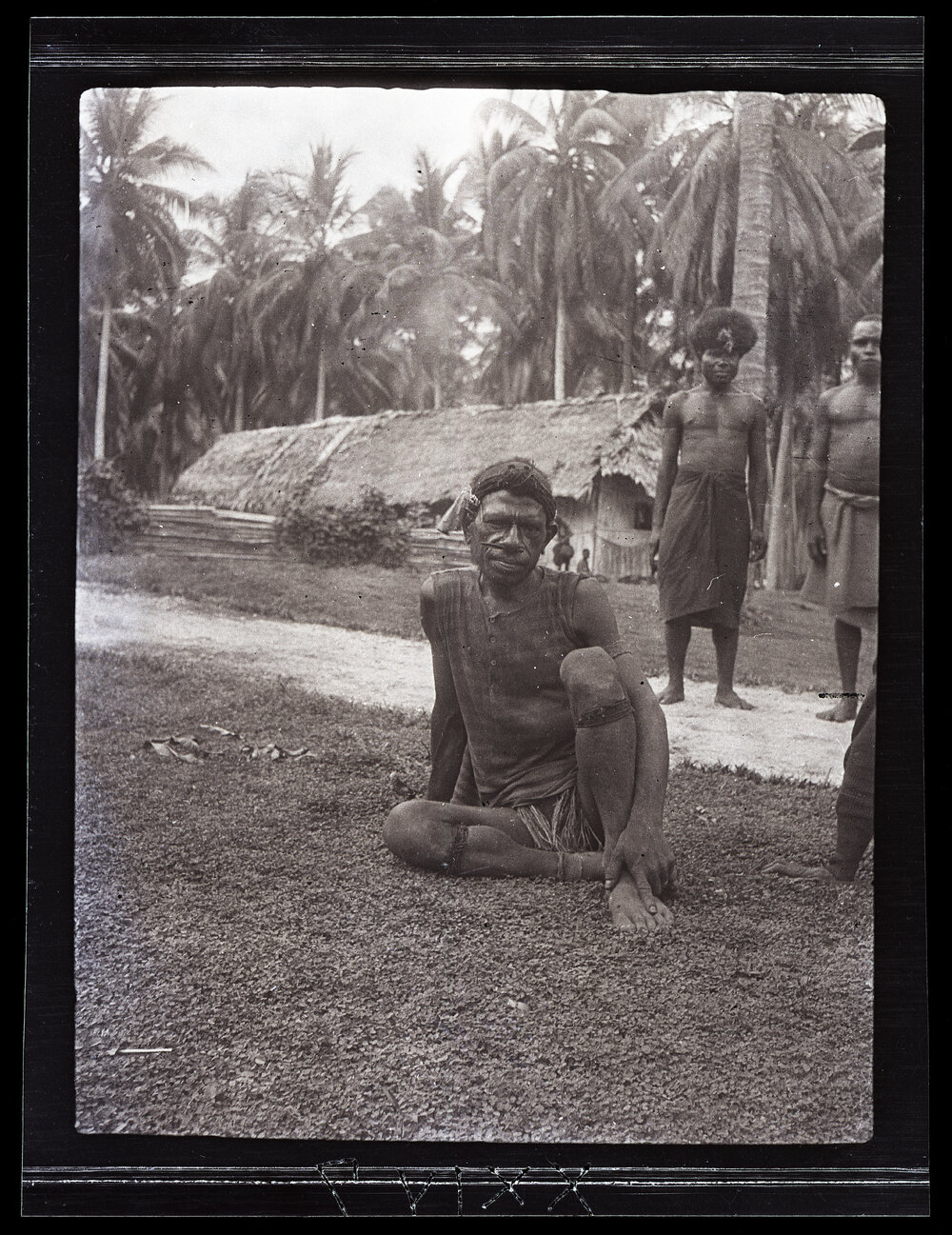 [Manum Island, New Guinea] ? An Old Man of Boroi with a Nose Stick