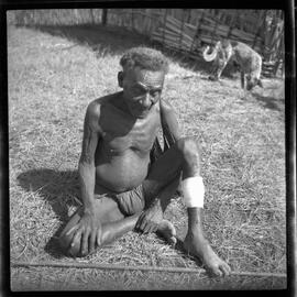 Man Sitting with Bandaged Leg