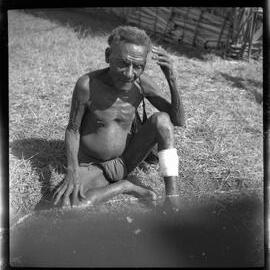 Man Sitting with Bandaged Leg
