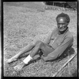 Man Sitting with Bandaged Leg
